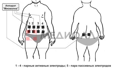 Массажер для простаты сделать своими руками 4