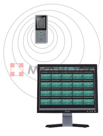 Система мониторинга вливания SN-M100