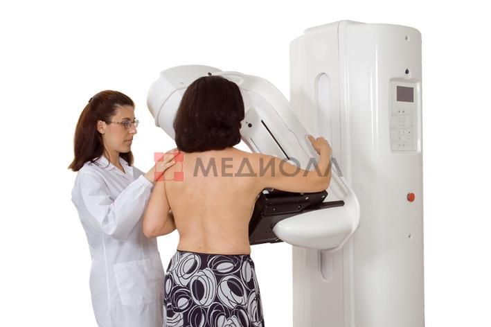 Gaia - аналоговый маммограф