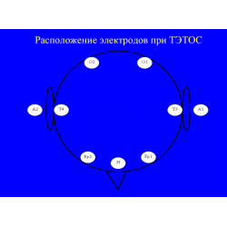 Диагностико-терапевтический комплекс транскраниальной электротерапии с обратной связью