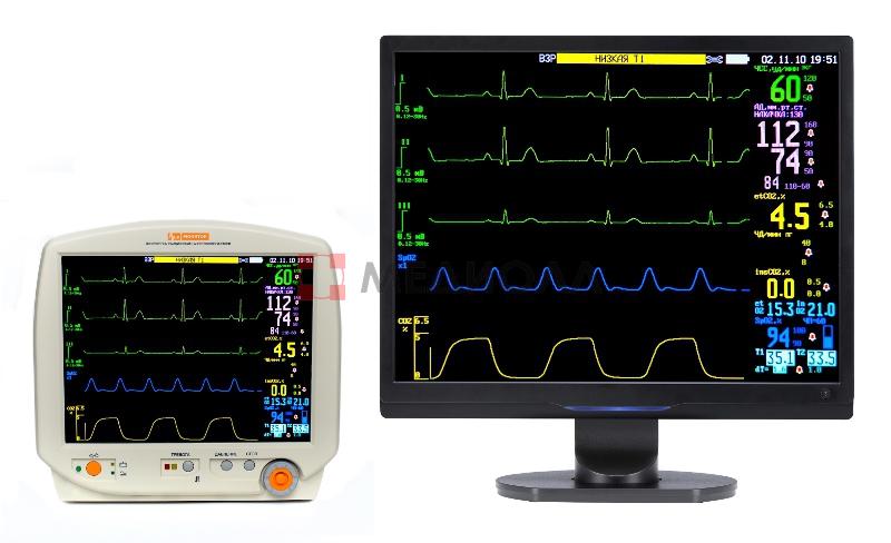 Системы мониторинга пациента. Прикроватный монитор Митар-01-«р-д».. Монитор Митар-01 р-д. Монитор реанимационный и анестез Митар-01-р-д. Центральная мониторная станция.