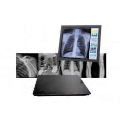 Ares RC DFP - цифровая рентгеновская система